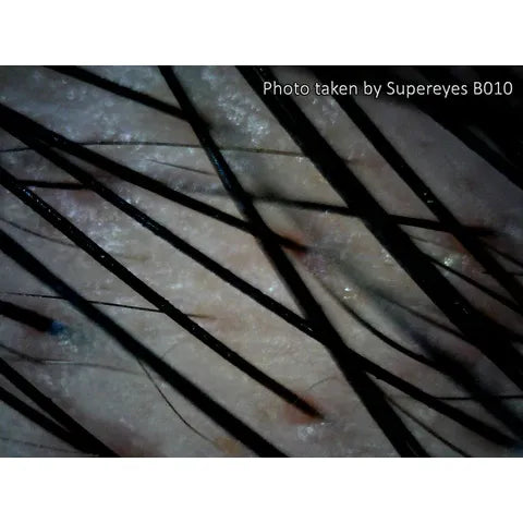 Supereyes B010 USB Digital Mikroskop Digitalmikroskop 1 bis 300-facher Vergrößerung mit LED-Beleuchtung und Stativ (Copy)