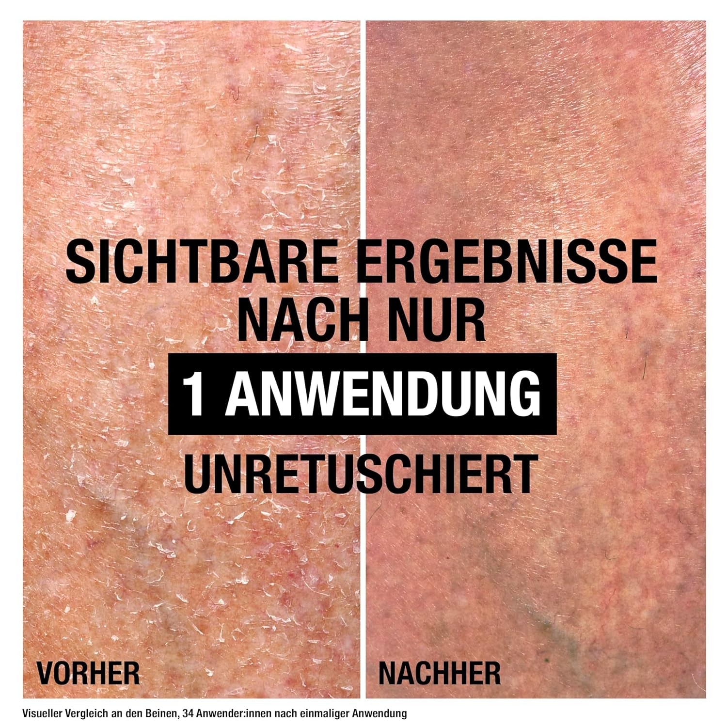 Neutrogena Norwegische Formel Intense Repair Reparierender CICA Bodybalsam 250 Ml Körperlotion Für Eine Sofortige Linderung Und Mehr Feuchtigkeit Bei Sehr Trockener, Rauer Haut